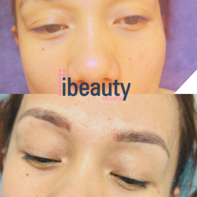 eyebrow before after 1