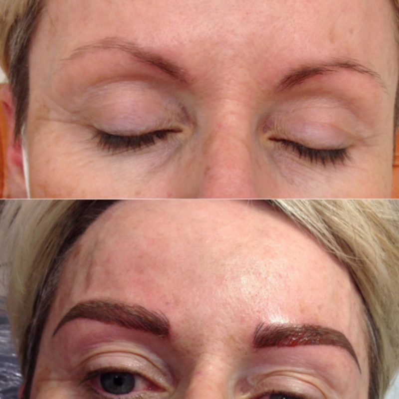 eyebrow before after 4