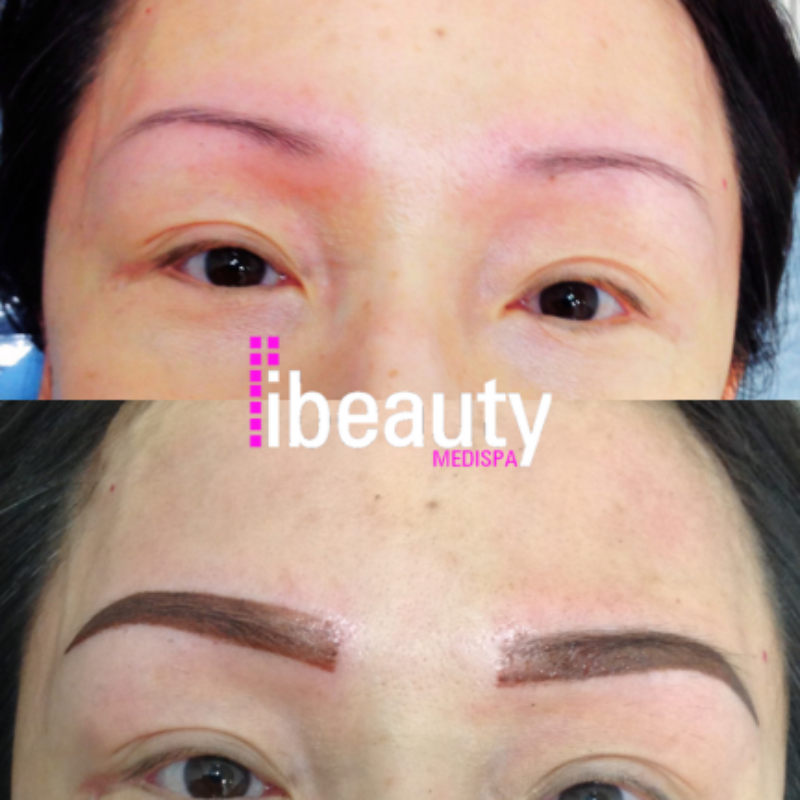 eyebrow before after 5