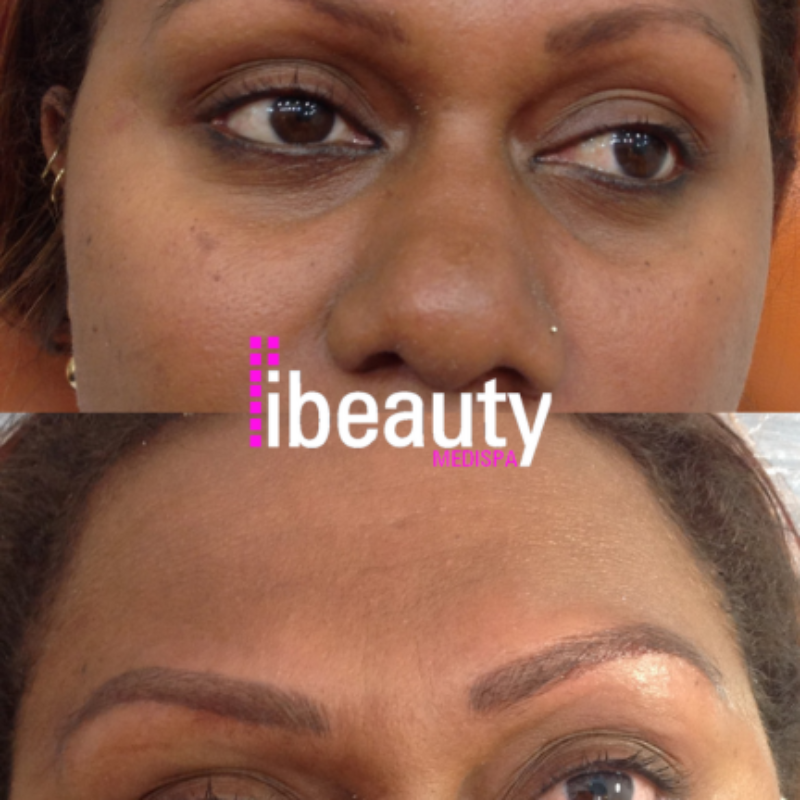 eyebrow before after 6